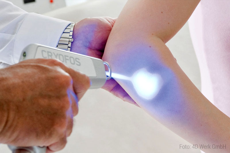Cryofos Köältetherapie in Burscheid